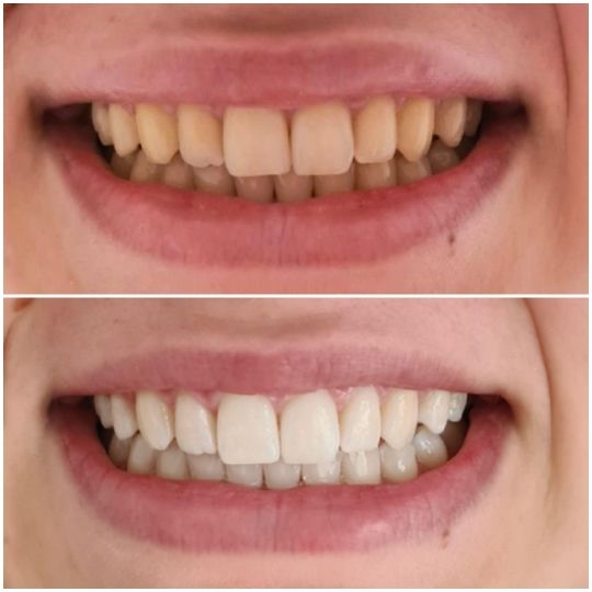 Enhance Your Smile, Enhance Your Beauty, BODYWORX